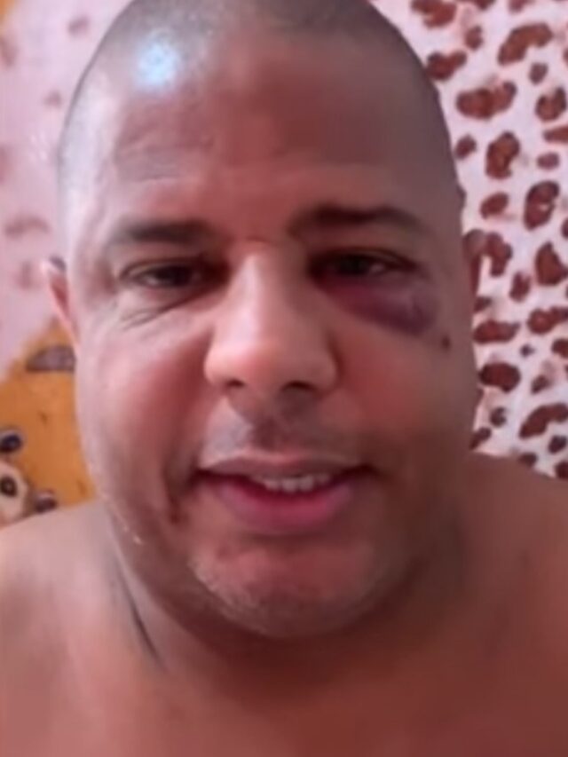 Marcelinho Carioca explica sequestro e aparece com olho roxo em vídeo